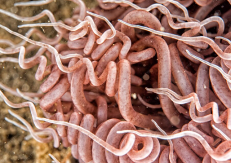 Imagem ampliada de vermes ou parasitas intestinais, com estruturas alongadas e curvas em tons rosados e esbranquiçados, representando contaminação ou infestação parasitária.